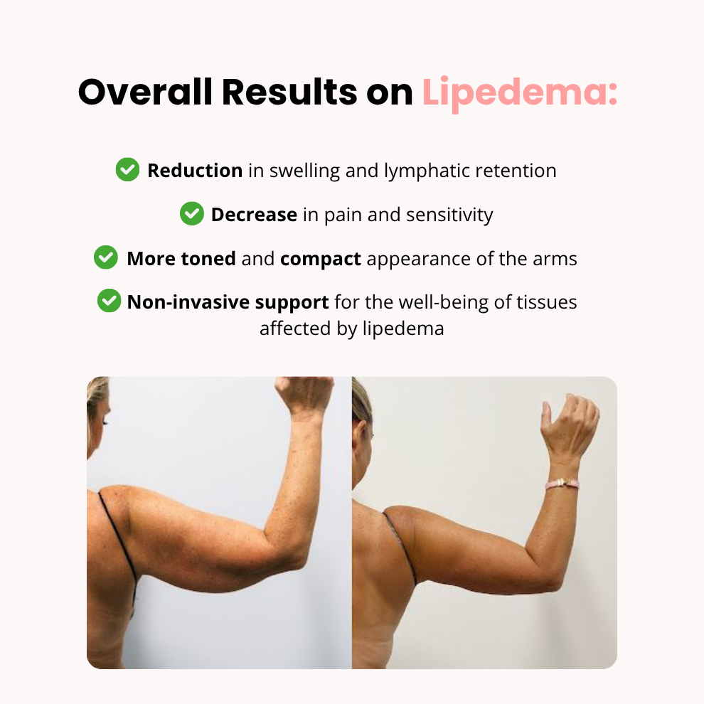 ZeloraSculpt Arm Band