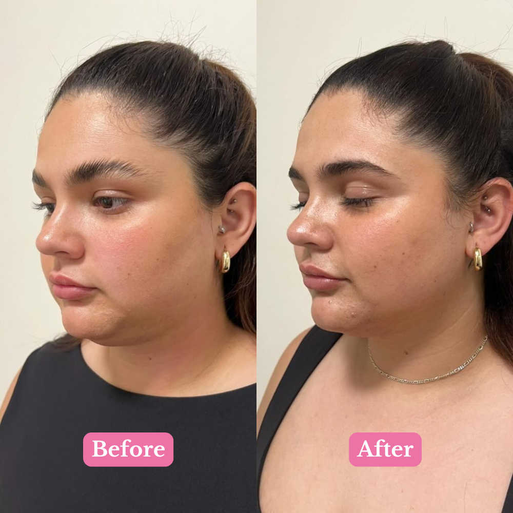 QueenBeauty Sleep Strips