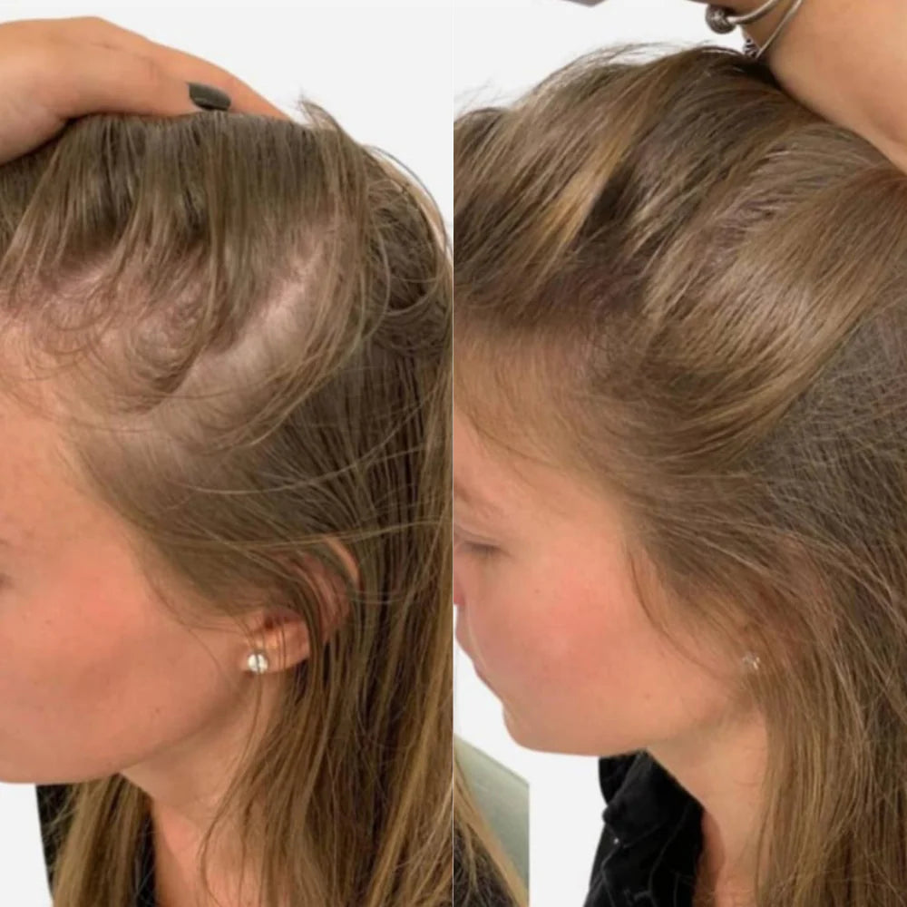 Pumpkin Seed Oil - Natural Hair Growth Formula