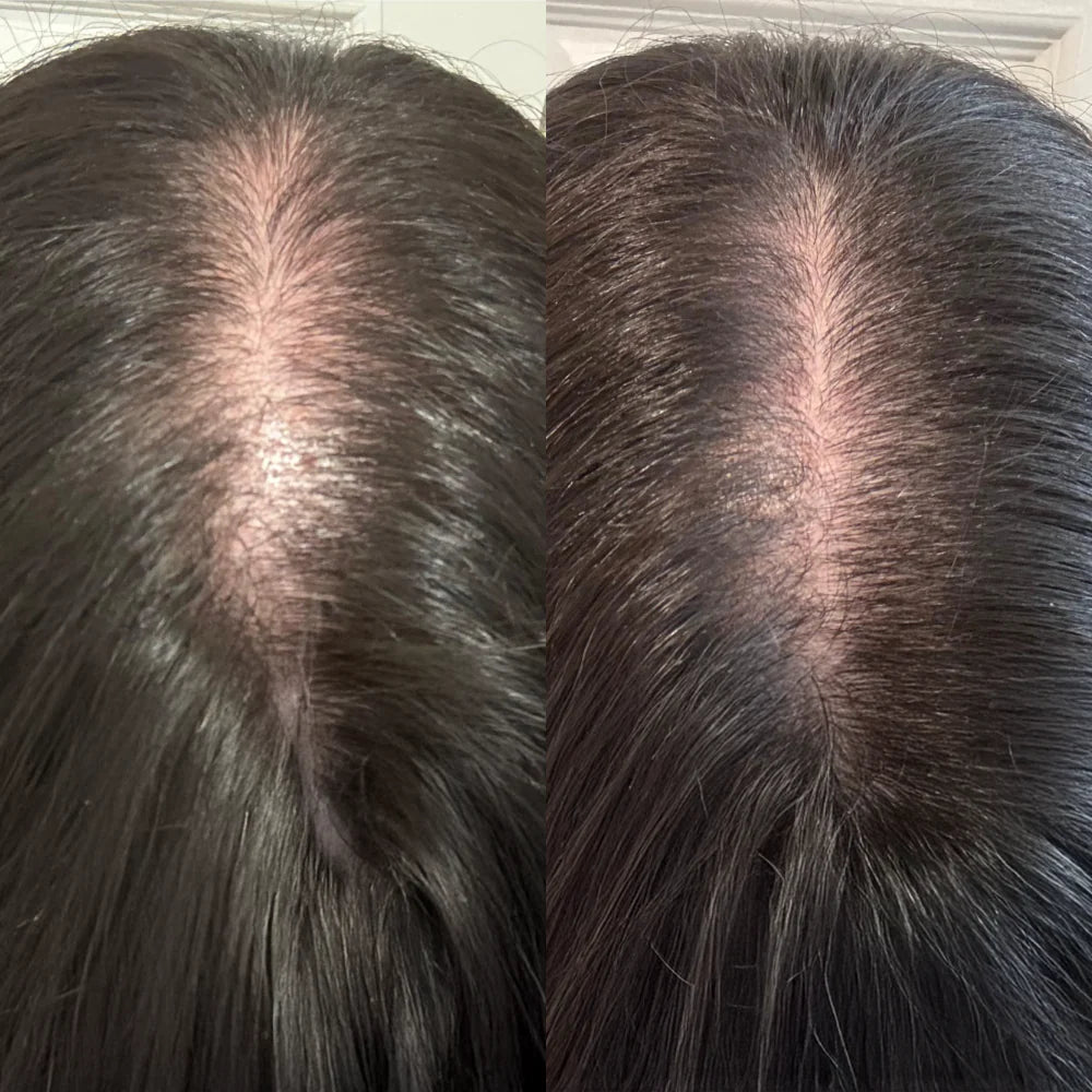 Pumpkin Seed Oil - Natural Hair Growth Formula